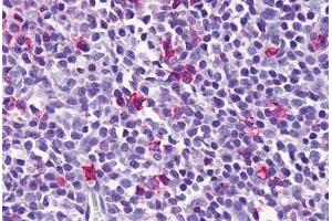 Anti-EMR3 antibody  ABIN1048550 IHC staining of human spleen, lymphocytes. (EMR3 antibody  (N-Term))