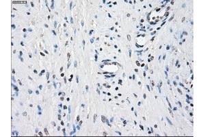 Image no. 9 for anti-Budding Uninhibited By Benzimidazoles 1 Homolog beta (Yeast) (BUB1B) antibody (ABIN1496996) (BUB1B antibody)