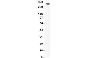 Western Blotting (WB) image for anti-Calcium Channel, Voltage-Dependent, L Type, alpha 1D Subunit (CACNA1D) (C-Term) antibody (ABIN3030255)