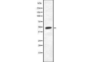 Western blot analysis of TMPRSS3 using K562 whole cell lysates (TMPRSS3 antibody  (Internal Region))