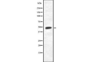 Western blot analysis of TMPRSS3 using K562 whole cell lysates
