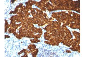 Immunohistochemistry (IHC) image for anti-Chromogranin A (CHGA) antibody (ABIN6939121)