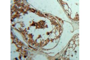 Used in DAB staining on fromalin fixed paraffin-embedded Testis tissue (PTH2R antibody  (AA 27-145))