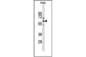 Western blot analysis of Glypican-1 / GPC1Antibody (N-term) in Hela cell line lysates (35ug/lane).