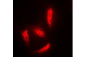 Immunofluorescent analysis of Histone Deacetylase 5 staining in HeLa cells. (HDAC5 antibody  (Center))