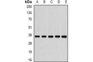 Western blot analysis of PSMD7 expression in MCF7 (A), A549 (B), K562 (C), mouse heart (D), mouse testis (E) whole cell lysates.