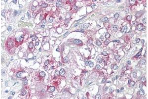 Anti-KCNH3 antibody IHC staining of human adrenal. (KCNH3 antibody  (AA 684-733))