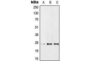 Western blot analysis of IPP1 expression in MCF7 (A), SP2/0 (B), PC12 (C) whole cell lysates. (PPP1R1A antibody  (Center))