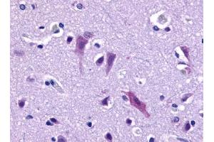 Immunohistochemical staining of Brain (Neurons and Glia) using anti- GPR103 antibody ABIN122109 (QRFPR antibody)