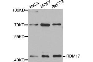 Western Blotting (WB) image for anti-RNA Binding Motif Protein 17 (RBM17) antibody (ABIN1875451)