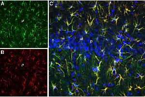 Multiplex staining of CLEC7A and GFAP in rat hippocampal CA1 regionImmunohistochemical staining of perfusion-fixed frozen rat brain sections with Anti-CLEC7A/Dectin-1 (extracellular) Antibody (ABIN7237603, ABIN7316623 and ABIN7316624), (1:600), followed by goat anti-rabbit-AlexaFluor-488 and Guinea Pig Anti-GFAP Antibody (ABIN7237688, ABIN7316585 and ABIN7316586), (1:600), followed by goat anti-guinea pig-AlexaFluor-594. (GFAP antibody  (Intracellular))