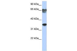 Western Blotting (WB) image for anti-NK3 Homeobox 2 (NKX3-2) antibody (ABIN2458009) (NKX3-2 antibody)