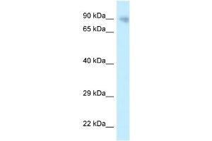 WB Suggested Anti-PPP6R3 Antibody Titration: 1. (PPP6R3 antibody  (N-Term))