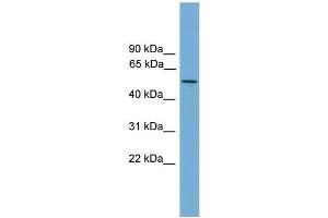 Human NCI-H226; WB Suggested Anti-EFCAB3 Antibody Titration: 0. (EFCAB3 antibody  (N-Term))
