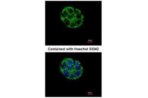 ICC/IF Image Immunofluorescence analysis of methanol-fixed Hep G2, using ASB5, antibody at 1:500 dilution. (ASB5 antibody)