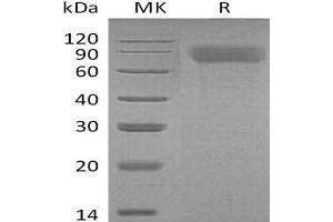 Western Blotting (WB) image for Thrombopoietin (THPO) protein (His tag) (ABIN7320657) (Thrombopoietin Protein (THPO) (His tag))