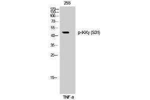 Western Blotting (WB) image for anti-Inhibitor of kappa Light Polypeptide Gene Enhancer in B-Cells, Kinase gamma (IKBKG) (pSer31) antibody (ABIN3182524) (IKBKG antibody  (pSer31))