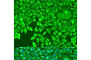 Immunofluorescence analysis of U2OS cells using pum1 Polyclonal Antibody at dilution of 1:100. (PUM1 antibody)