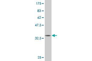 Western Blot detection against Immunogen (36. (CITED1 antibody  (AA 94-193))