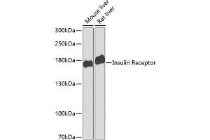 Western blot analysis of extracts of various cell lines using Insulin Receptor Polyclonal Antibody at dilution of 1:1000. (Insulin Receptor antibody)