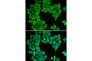 Immunofluorescence analysis of HeLa cells using SPAG5 antibody (ABIN6290586). (SPAG5 antibody)