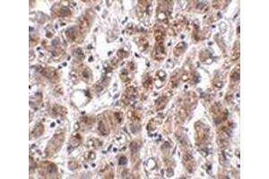 Immunohistochemistry of THEM2 in human liver tissue with this product at 2. (THEM2 antibody  (C-Term))