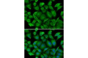 Immunofluorescence analysis of HeLa cells using DEFA1 antibody. (alpha Defensin 1 antibody  (AA 1-94))
