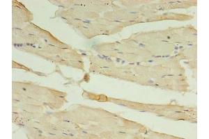Immunohistochemistry of paraffin-embedded human skeletal muscle tissue using ABIN7146727 at dilution of 1:100 (CA5B antibody  (AA 34-314))