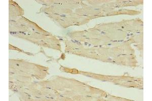 Immunohistochemistry of paraffin-embedded human skeletal muscle tissue using ABIN7146727 at dilution of 1:100