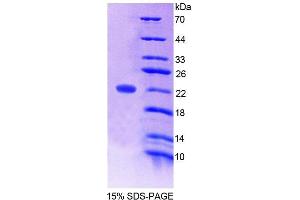 SDS-PAGE (SDS) image for Angiopoietin-Like 4 (ANGPTL4) (AA 228-389) protein (His tag) (ABIN6238909) (ANGPTL4 Protein (AA 228-389) (His tag))