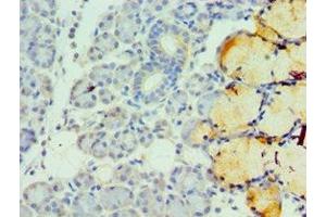 Immunohistochemistry of paraffin-embedded human pancreatic tissue using ABIN7173326 at dilution of 1:100 (TFF1 antibody  (AA 25-84))