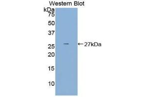 Western blot analysis of the recombinant protein. (DCL1 antibody  (AA 21-225))