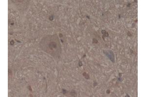 Detection of MFAP2 in Rat Spinal cord Tissue using Polyclonal Antibody to Microfibrillar Associated Protein 2 (MFAP2) (MFAP2 antibody  (AA 8-171))