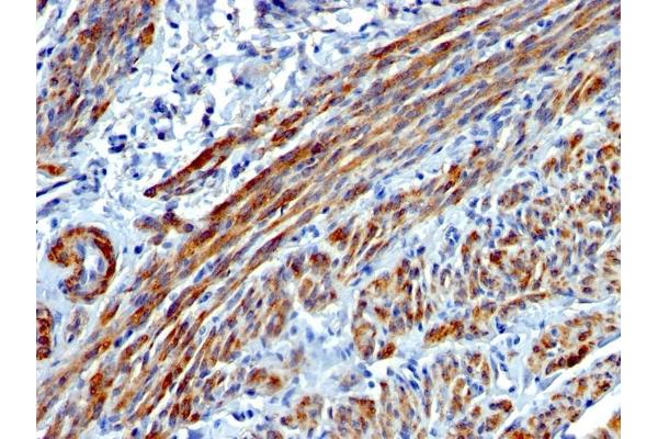 MYH11 antibody