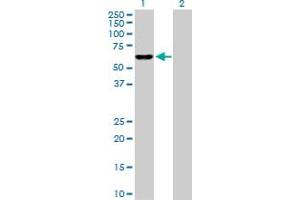 Western Blot analysis of IDH3B expression in transfected 293T cell line by IDH3B MaxPab polyclonal antibody.