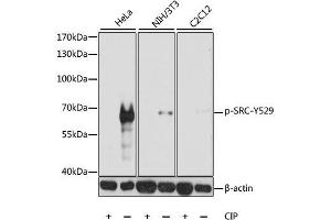 Western blot analysis of extracts of various cell lines, using Phospho-SRC-Y529 antibody. (Src antibody  (pTyr529))