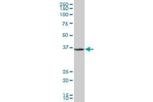 CIAPIN1 polyclonal antibody (A01), Lot # 060516JCS1 Western Blot analysis of CIAPIN1 expression in HepG2 . (CIAPIN1 antibody  (AA 266-367))