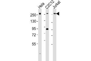 All lanes : Anti-Med12 Antibody (C-term) at 1:2000 dilution Lane 1: Hela whole cell lysates Lane 2: C2C12 whole cell lysates Lane 3: Jurkat whole cell lysates Lysates/proteins at 20 μg per lane. (MED12 antibody  (C-Term))