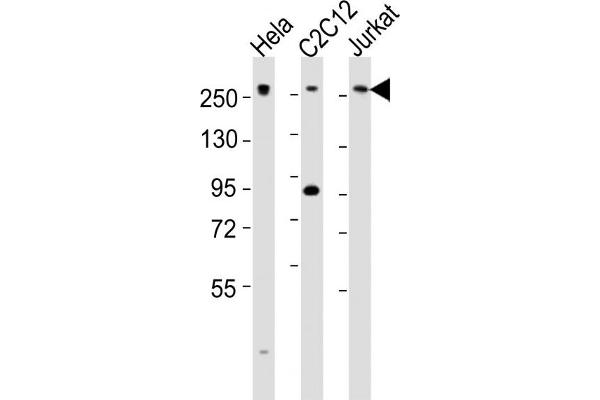 MED12 抗体  (C-Term)
