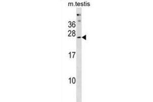 Western Blotting (WB) image for anti-Phosphatase, Orphan 2 (PHOSPHO2) antibody (ABIN3001017) (PHOSPHO2 antibody)
