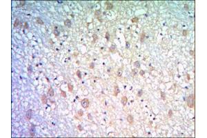 Immunohistochemical analysis of paraffin-embedded human brain tissues using KLHL21 antibody with DAB staining. (KLHL21 antibody)