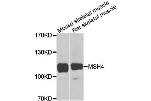 Western blot analysis of extracts of various cell lines, using MSH4 antibody (ABIN5996306) at 1/1000 dilution. (MSH4 antibody)