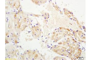 Formalin-fixed and paraffin embedded mouse heart labeled with Anti-WNT10B Polyclonal Antibody, Unconjugated (ABIN702295) at 1:200 followed by conjugation to the secondary antibody (WNT10B antibody  (AA 201-300))