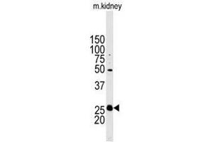 Image no. 1 for anti-Stanniocalcin 2 (STC2) (N-Term) antibody (ABIN356935) (Stanniocalcin 2 antibody  (N-Term))