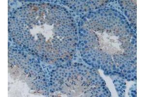 IHC-P analysis of Mouse Testis tissue, with DAB staining.