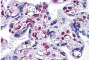 Human Placenta: Formalin-Fixed, Paraffin-Embedded (FFPE) (STK33 antibody  (AA 1-515))