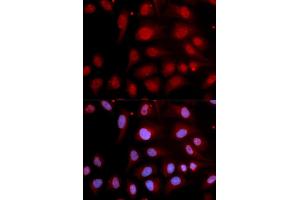 Immunofluorescence analysis of U2OS cells using POLB antibody (ABIN5970839). (POLB antibody)