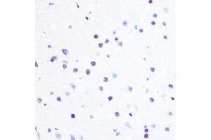 Immunohistochemistry of paraffin-embedded rat brain using PEG3 Rabbit pAb (ABIN6128527, ABIN6145434, ABIN6145435 and ABIN6216398) at dilution of 1:100 (40x lens).