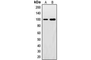 Western blot analysis of Synphilin 1 expression in HeLa (A), U2OS (B) whole cell lysates. (SNCAIP antibody  (C-Term))