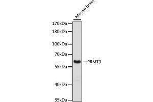 Western blot analysis of extracts of mouse brain, using PRMT3 antibody (ABIN6129634, ABIN6146229, ABIN6146230 and ABIN6216919) at 1:3000 dilution. (PRMT3 antibody  (AA 1-220))